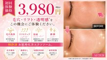 アンテグラール
