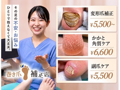 巻き爪補正店 仙台駅前店の写真