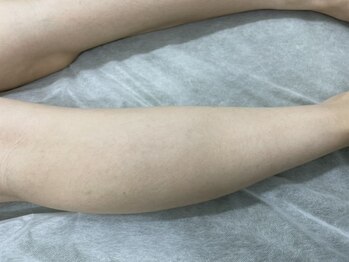 ナノハナ/鹿沼市の全身脱毛美容室ナノハナ