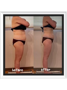 ソワン(soin)/★結果重視のサイズダウン★