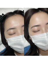 テテ(TeTe)/ハリウッドブロウリフト