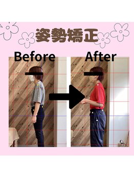 鷺沼駅前整骨院 鍼灸マッサージ院/姿勢矯正ビフォーアフター