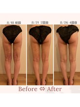 ファミーユ 名古屋店/【術後ケア】ダウンタイム軽減