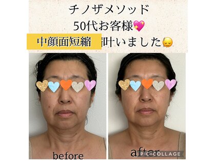 ルース(LUCE)の写真