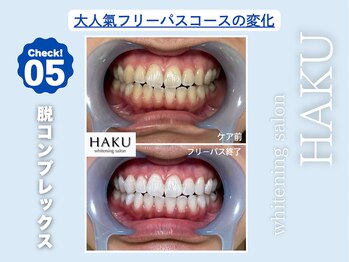 ハク 袋井磐田店(HAKU)/お客様before→after 5