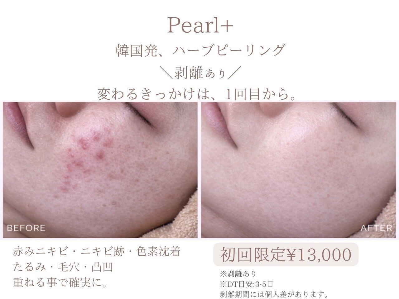 パールプラス 那須塩原黒磯店(Pearl plus)｜ホットペッパービューティー