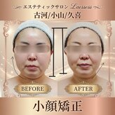 ラエッセス(A Laessess)