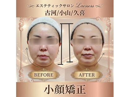 ラエッセス(A Laessess)の写真