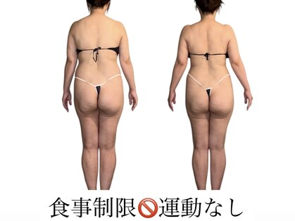 ビチル 薬院(美chill)の写真
