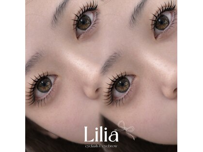 リリア(Lilia)の写真
