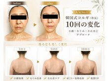 アグレーブル(Agreable)の雰囲気（お顔だけじゃない。身体もすっきり、姿勢改善＆慢性こりをケア◎）