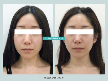 ソウルスキンの写真/骨格・顔の筋肉を整え、フェイスラインを強力リフトアップ!話題の韓国式コルギで憧れの立体的な小顔に♪