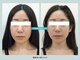 ソウルスキンの写真/骨格・顔の筋肉を整え、フェイスラインを強力リフトアップ!話題の韓国式コルギで憧れの立体的な小顔に♪