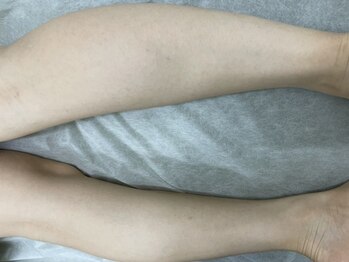 ナノハナ/鹿沼市の全身脱毛美容室ナノハナ