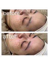 ラクシー 北千住(luxssy)/シェービング×眉パーマ＆wax