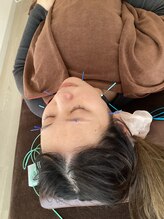 ハリファ鍼灸院 横浜関内院(HariFa鍼灸院)/美容施術