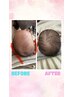 【☆あかちゃんゆるBabyセラピー】赤ちゃんの向き癖、頭の形を整えます。