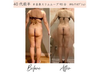 メルローズ 自由が丘店(Melrose)/【お客様の効果写真】