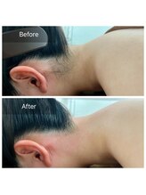 ミュア(myua.)/うなじワックス Before After