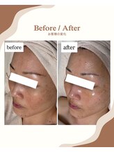 エムイーボーテ(me.Beaute)/【セルマン】美容好きが選ぶ