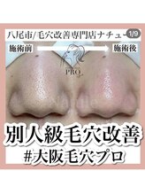 ナチュール(Natule)/毛穴改善コース