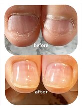 ミリアネイル 成城(Miliea nail)/