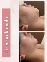 キレイノカタチ(Kirei No Katachi)