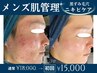【メンズ肌管理】ニキビ・毛穴悩みに◎ハーブピーリング ¥18000→¥15000
