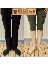 横浜DRT矯正院/O脚矯正
