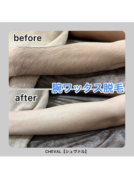 シュバル(CHEVAL)/当日ツルスベ肌GET！