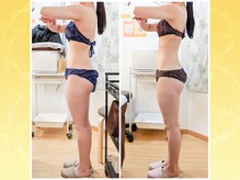 ビーレ袋町/[美容機器]しなやかな美しさ