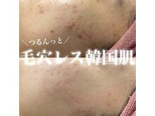 ルアナマナ(Luana Mana)/陶肌トリートメント