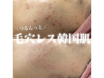 ルアナマナ(Luana Mana)/陶肌トリートメント