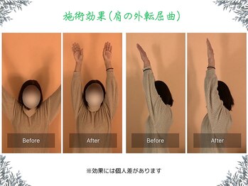 ボディ リセット アンド デザイン(Body Reset & Design)/【施術例】ビフォーアフター