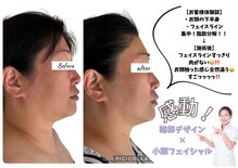 ルピナージュ(Lupinage)