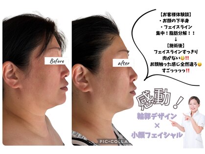 ルピナージュ(Lupinage)の写真