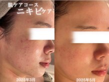 アールエーサロン 恵比寿 広尾(Ra salon)