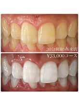 ホワイトニングルーム 横浜店(Whitening Room)/セルフホワイトニング/横浜