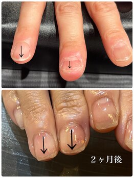 リナ ネイル(Rina nail)/