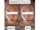エム シャルール(M chaleur)の写真/1回目でも実感!毛穴・ホワイトニング・シミ・たるみケアで理想の水光ツヤ肌へ