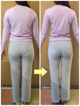 美容整体専門院 新美選/スタイルアップ整体 変化写真