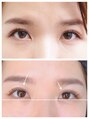ロイル コア ビューティー(Loeyle core beauty)&nbsp;まつ毛の癖、状態見極めお似合いデザイン/ミルフィーユラッシュ