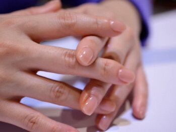 フィオーレフィオーレ 銀座の写真/【爪質トリートメント】美爪を叶える特許取得のネイル技術！コンプレックス爪解消♪