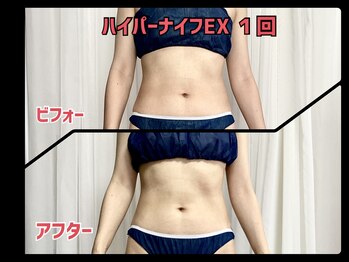 リヘッド(Re.head)/ハイパーナイフEXでくびれ集中