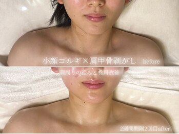 ラ ドゥーサ(La Dusa)/肩凝りさん必見!キャシャ見え♪