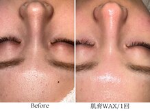 ビボーラ(BEBEAURA)/肌育WAXで産毛や角栓を一掃