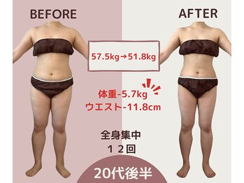 エテルナ(Eterna)/安城市　ダイエット　痩身