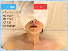ティアワン 麻布十番(Tierone)/首肩Before & After