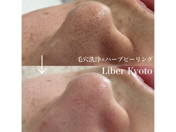 リベルキョウト 京都駅前店(Liber Kyoto)/毛穴レス艶肌コース