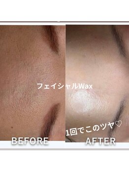 フレル(FUREL)/産毛を除去で肌トーンUP!